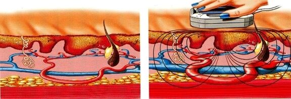 ако нозете ви се вкочанат